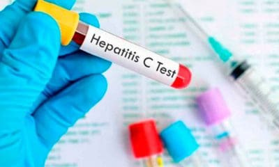 Solo 20 por ciento de los infectados con hepatitis C conocen su afección. | Foto: @AlertaDigitalDo