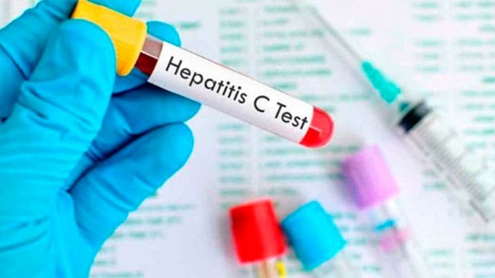 Solo 20 por ciento de los infectados con hepatitis C conocen su afección. | Foto: @AlertaDigitalDo