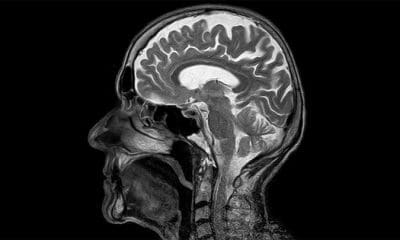 Imagen Ilustrativa / Pixabay / toubibe