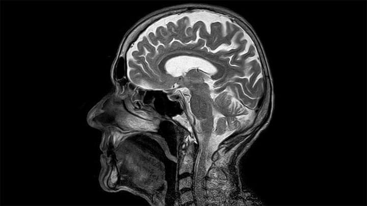 Imagen Ilustrativa / Pixabay / toubibe