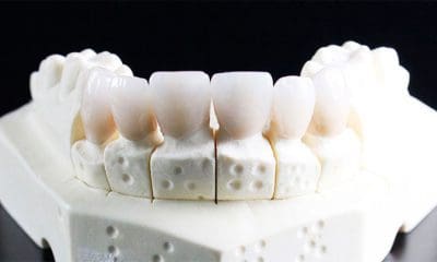 / Imagen ilustrativa Pixabay / dental-inno