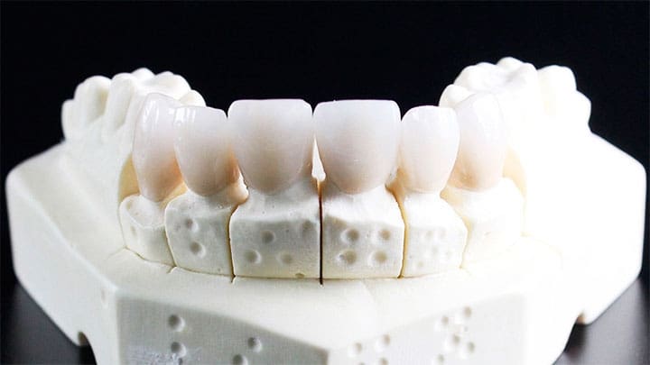 / Imagen ilustrativa Pixabay / dental-inno