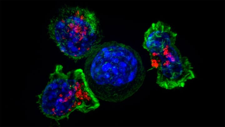 / Grupo de células T asesinas. Flickr.com / NIH Image Gallery