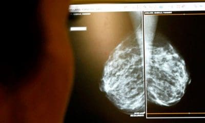 / Un médico examina unas mamografías. Eric Gaillard / Reuters