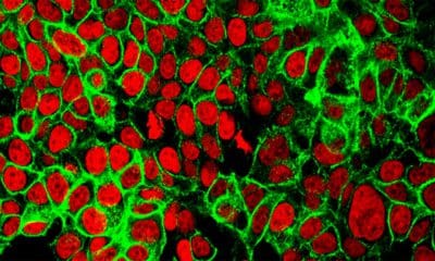 / Células de cáncer de colon bajo un microscopio NCI Center for Cancer Research