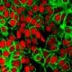/ Células de cáncer de colon bajo un microscopio NCI Center for Cancer Research