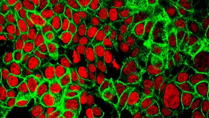 / Células de cáncer de colon bajo un microscopio NCI Center for Cancer Research
