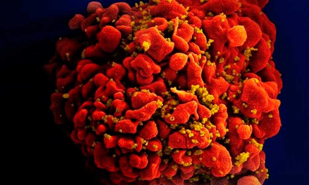 Hallan una combinación de anticuerpos que suprime el VIH durante meses