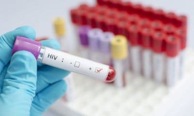 Eliminan la presencia del virus del VIH en cinco pacientes mediante trasplantes de células madre