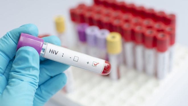 Eliminan la presencia del virus del VIH en cinco pacientes mediante trasplantes de células madre