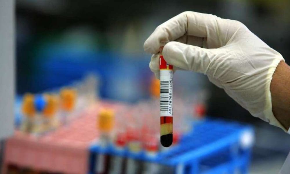 Foto: David Silverman (Getty Images)